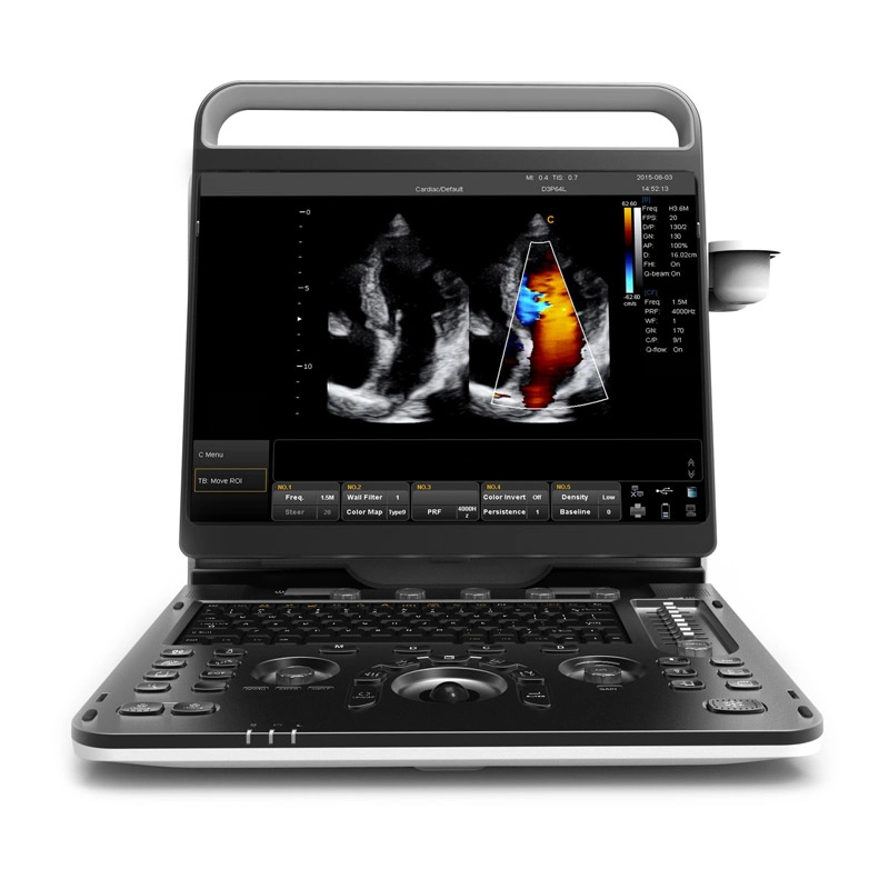 Chison Ebit30 4D 5D Portable Color Doppler Digital Dianostic Imaging System Human Ultrasound Gynecology, Cardiovascular Echo Machine