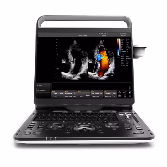 Chison Ebit30 4D 5D ポータブルカラードップラーデジタル診断イメージングシステム人間の超音波婦人科、心臓血管エコーマシン